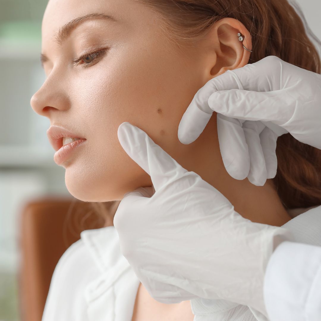 Skin examination by a professional in gloves.